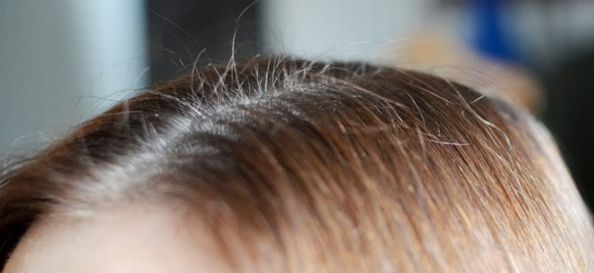 Масло rapidway активатор роста волос
